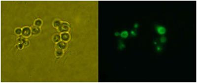 Energy Charge as an Indicator of Pexophagy in <mark class="highlighted">Pichia pastoris</mark>